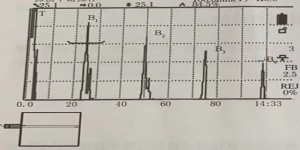 板材內(nèi)部缺陷常用的超聲波檢測(cè)方法有哪些？
